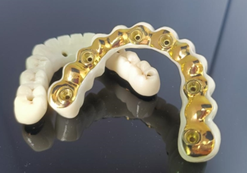 Barra Ionchlannaithe Tíotáiniam CAD/CAM + Droichead Zirconia