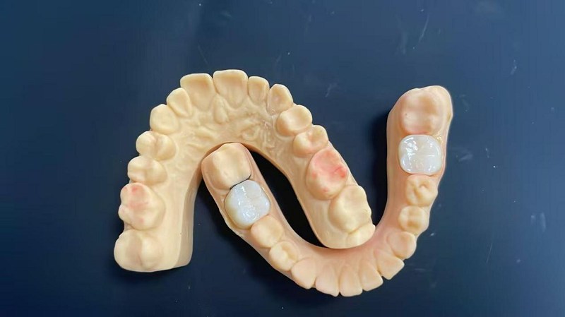 Cad é an imeall ghualainn?