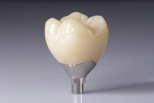 Optamaigh Do Thorthaí le Athchóirithe Zirconia (Coróiní, Droichid, Ionchlannáin)