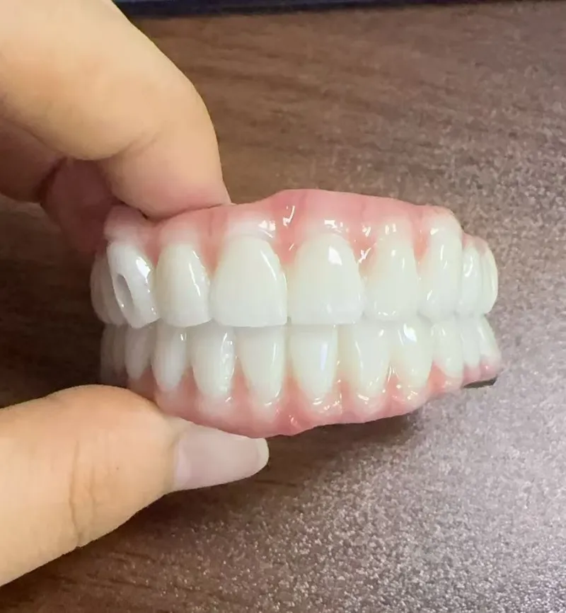 Guaiseacha Malocclusion