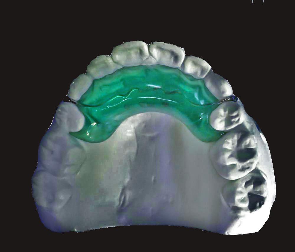 Eitleán Giotán Anterior Claonta