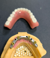 Aimsitheoir agus barra fiaclóireachta